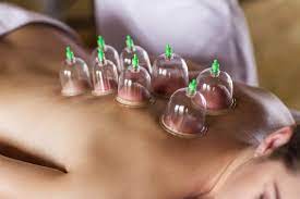 cuppingtherapie voor ontspanning en pijnverlichting bij San Fulgencio, Spanje."